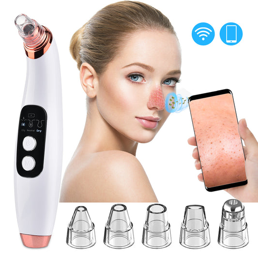 Electric Blackhead Remover-Ultrasonic vibration