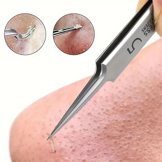 Acne Blackhead Tweezers.