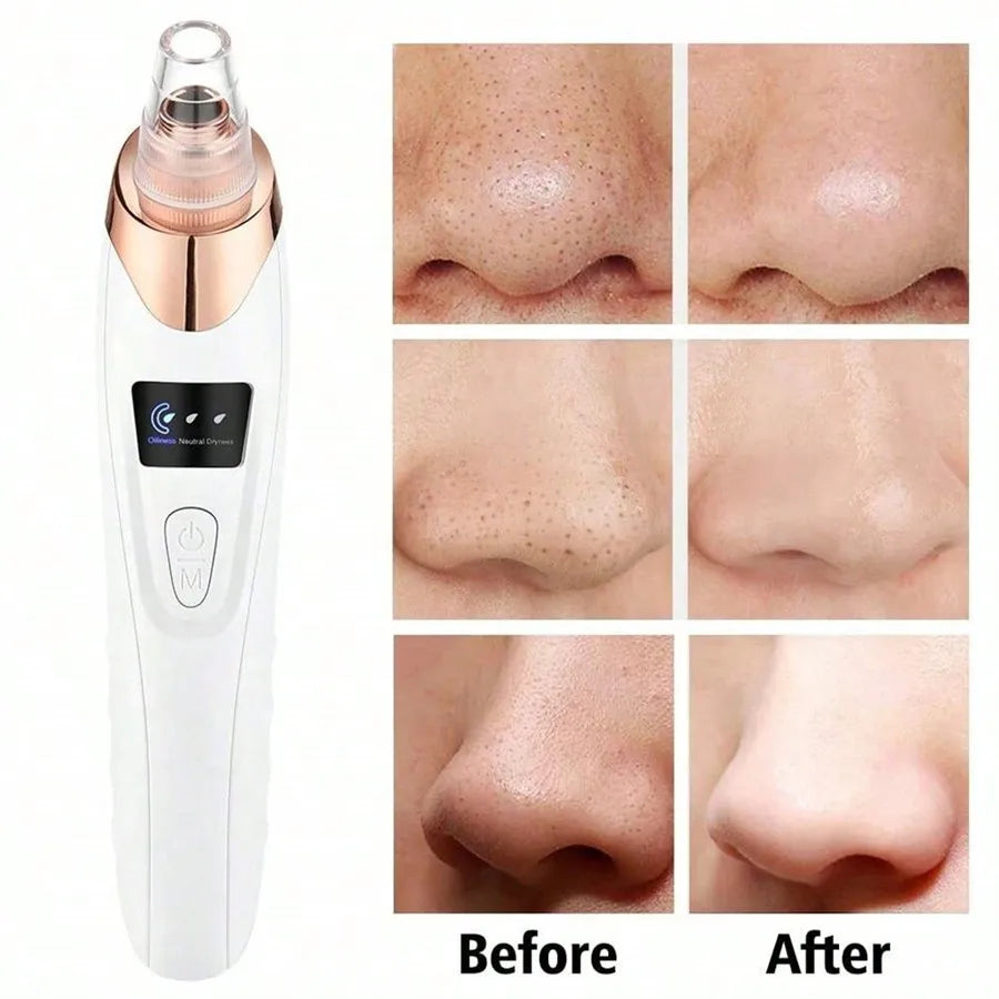 Electric Blackhead Remover Vacuum Cleaner.