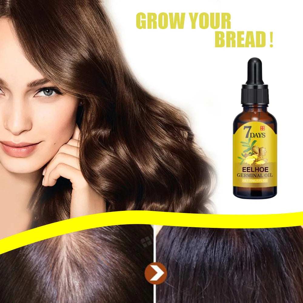 EELHOE Ginger Hair Growth Oil.