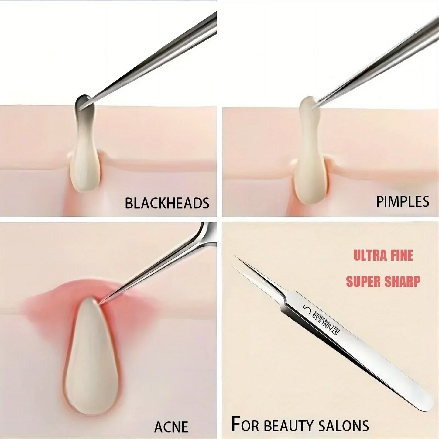 Acne Blackhead Tweezers.