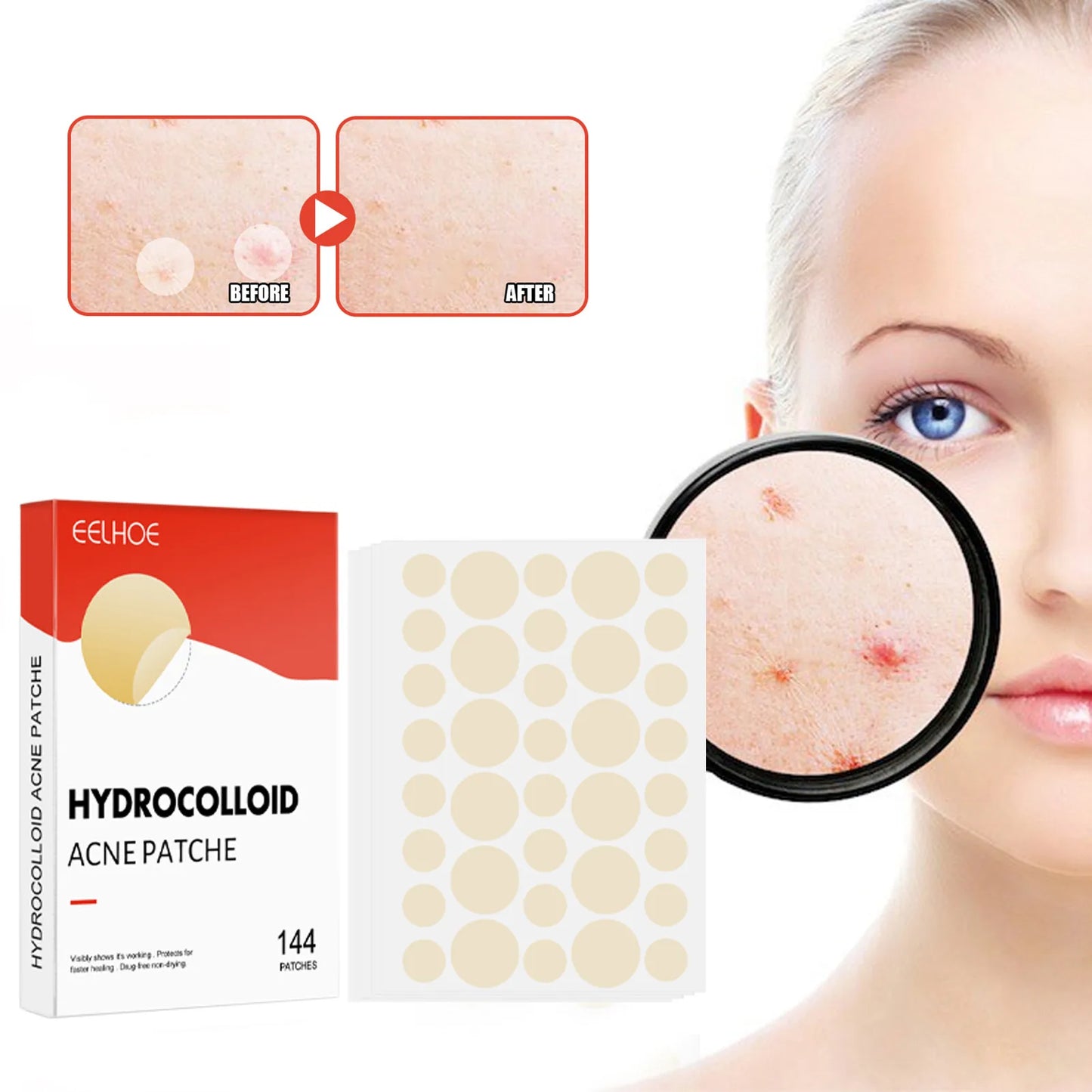 144pcs/set Face Skin Care Acne Pimple Patch.