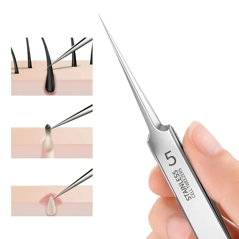 Acne Blackhead Tweezers.