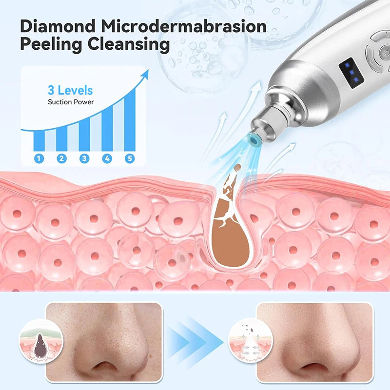 Upgraded Diamond Microdermabrasion Facial Machine.