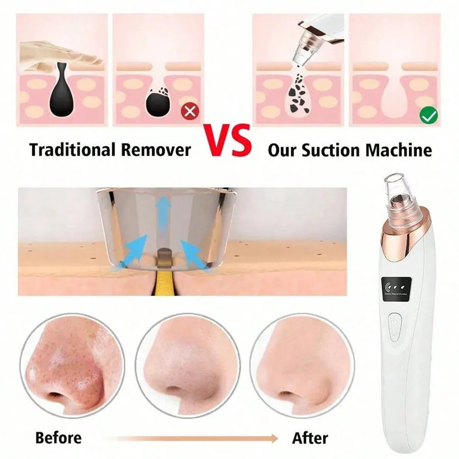 Electric Blackhead Remover Vacuum Cleaner.